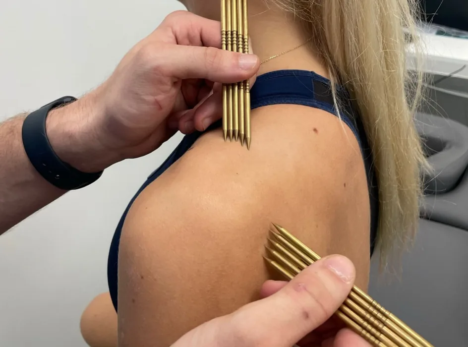 Kinesiotaping barku wykonywany przez fizjoterapeutę Jana Kaczmarka w Poznaniu